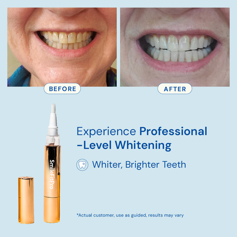Whitening Wonder Serum 