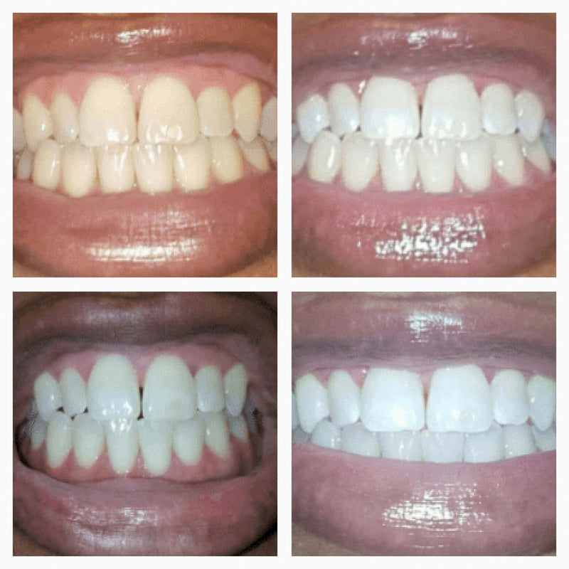 Whitening Wonder Serum 
