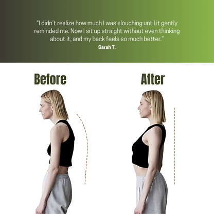 Posturo™ Smart Posture Trainer