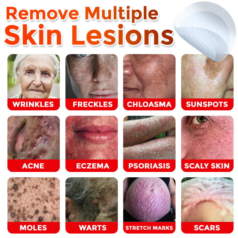 🌈 SkinPrikyn™ MicroNeedle Botanic Skin Tag Removal Patch 🇺🇸 Made in the USA