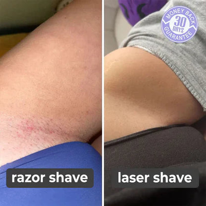 SILK SMOOTH™ - Laser Hair Remover (90% OFF TODAY ONLY!)